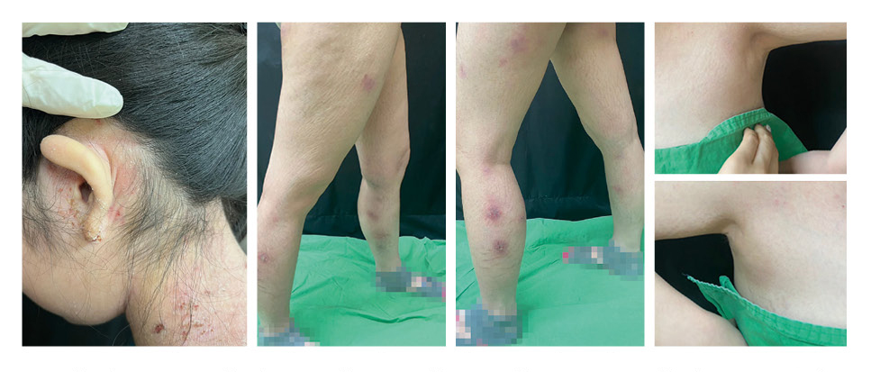 三軍醫訊NO255揮之不去的夢魘